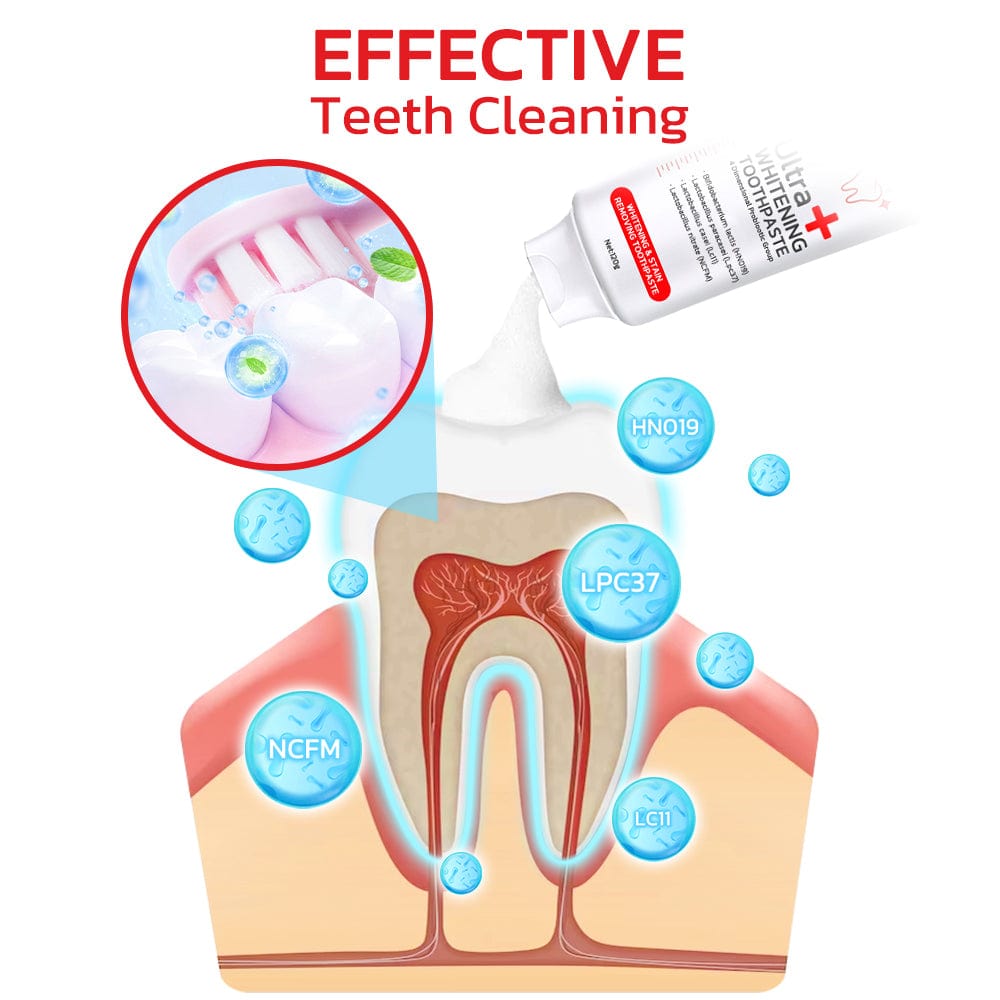 SP-4 Probiotic Teeth Whitening Toothpaste Buy 1 Get 1 Free! OFFER ENDS TODAY!